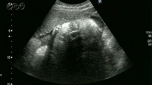 おなかの中の赤ちゃんのようす | NHK for School