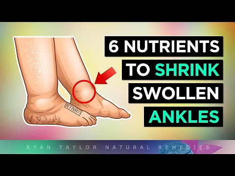 How To ELIMINATE Swollen Ankles & Legs (Supplements)