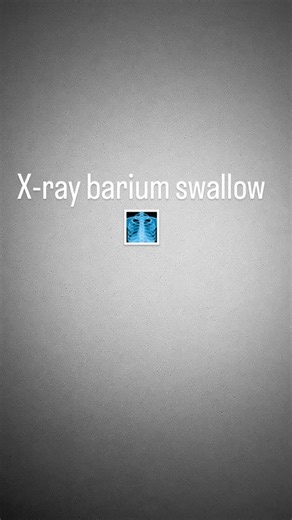 X-RAY- RADIOGRAPHY on Instagram: "X-ray barium swallow procedure 🩻 . . . #xraytech #xray_doctor #xraystudent #xrayproblems #xraytechnologist #medicalstudent #hospitality #medicallife #bariumxray #bariumswallow #medicalstudents👩‍⚕️💊💉 #radiographerlife☢️"