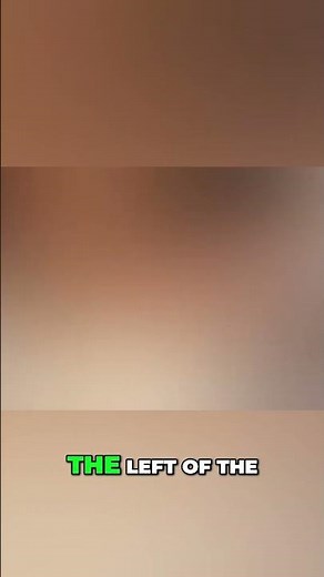 How to Self-Inject Safely: A Simple Guide #shorts