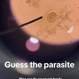 223K views · 2.1K reactions | Stool sample ❤️❤️ | Lab life | Facebook