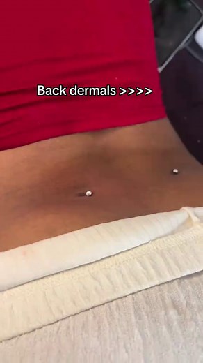 Understanding Back Dermal Piercings and Surface Dermal Repairs
