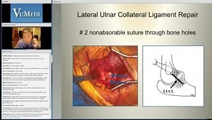 Terrible Triad Injuries