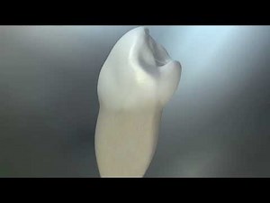 Smear Layer - Dr. Frank Cervone | Dentsply Sirona
