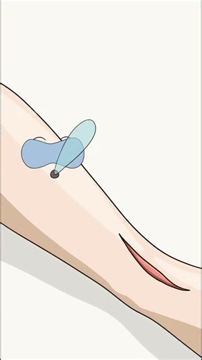 Dr.Healthcare on Instagram: "How Anesthesia Actually Works Inside Your Body?"