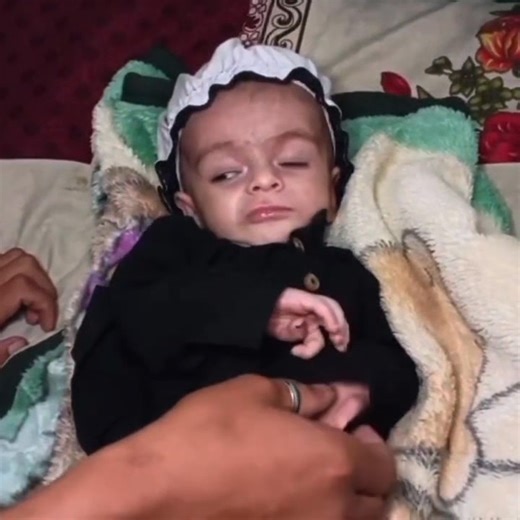 8 Sept 2025 — Family Update: Baby Abu Smiles, Plays & Fights with Uncle! | #BabyAbubakar​ Alhamdulillah — finally the family sent fresh home clips and our little fighter Baby Abu is smiling, playing with his uncle’s finger, and even giving a tiny playful “fight” — small moments that mean the world to everyone who has prayed for him. Today’s video is full of hope: calm feeds, bonding moments, and clear signs of improvement. 💙 In this upload you will see: • Baby Abu happily playing with his uncle