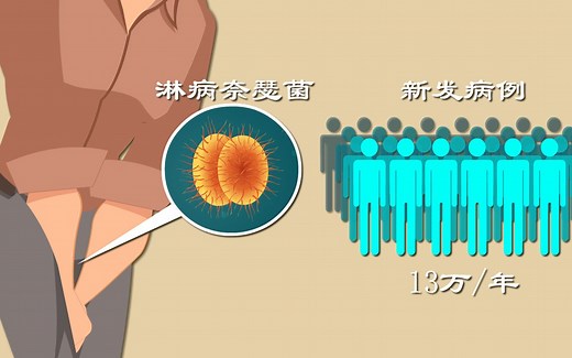 淋病1：淋病简史