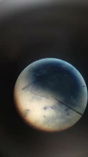 Nerve cell complete in microscope