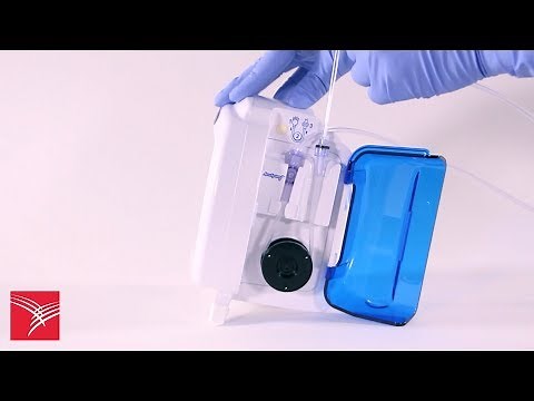 Preparing and loading the Kangaroo™ ePump Enteral Feeding Pump for feeding