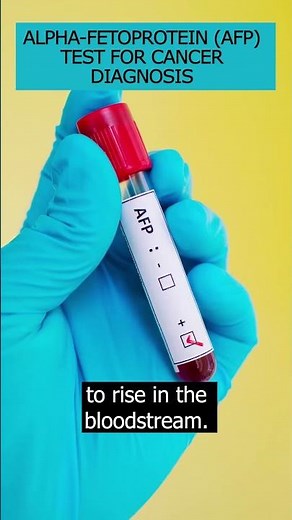 Discover Alpha-fetoprotein(AFP) test, its scientific basis & its role in diagnosing cancers #AFPTest