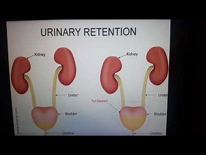 Urinary retention presentation