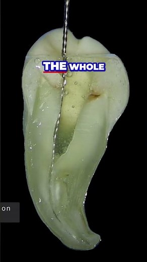 Mastering Tooth Preparation Avoiding Common Mistakes