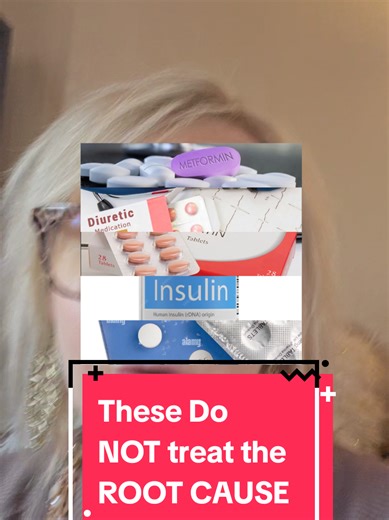 They gave you pills for sugar. Pills for blood pressure. Pills for cholesterol. Maybe even insulin. But notice the pattern? All of them manage symptoms. None of them fix the root cause. The real root cause is insulin resistance. High blood sugar, high blood pressure, high triglycerides, fatty liver, stubborn belly fat — these are all downstream problems. When insulin stays high for years, the whole system breaks. You don’t have a medication deficiency. You have a metabolic traffic jam. The good 
