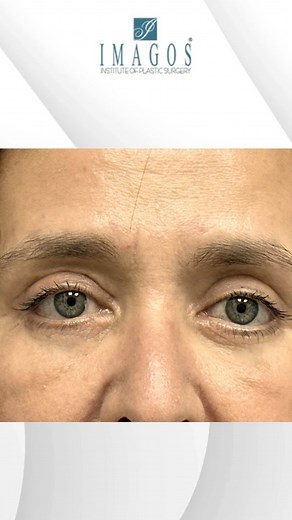 Imagos Plastic Surgery on Reels | Facebook