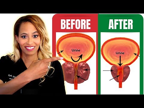 Shrink the Prostate: The #1 Important All-Natural Way | Dr Rachael