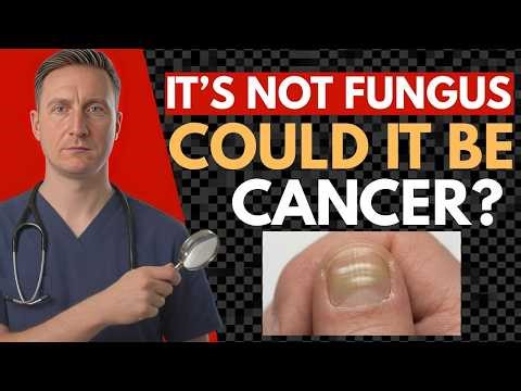LOOK AT YOUR NAILS RIGHT NOW! 8 Signs of Deadly Disease You Keep Ignoring | Dr. Michael Kent