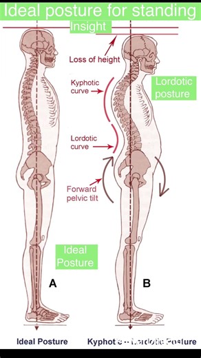 Ideal posture for standing. #health #fitnessgoals #fitness #fitnessmotivation #fitnessaddict #fit
