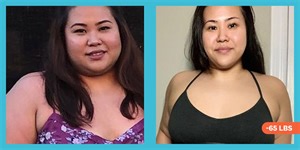 'I Lost 65 Pounds After I Reduced My Sugar And Started Doing Intermittent Fasting'