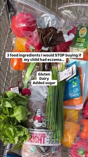 If I were starting over with a child struggling with eczema, these are the 3 foods I’d pause
