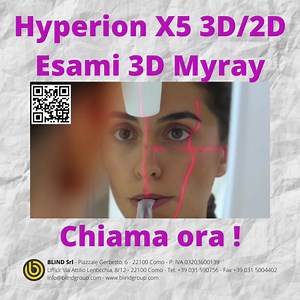 Hyperion X5 3D2D Esami 3D Myray #blindgroup #Myray #Hyperion #X5 | Blind Group