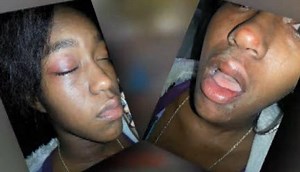 Sharkeisha Victim & Mother Speak Out After Incident Goes Viral!