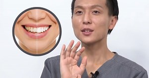 Dentists Clarify Why Some K-Pop Idols Appear To Have Unevenly Colored Teeth