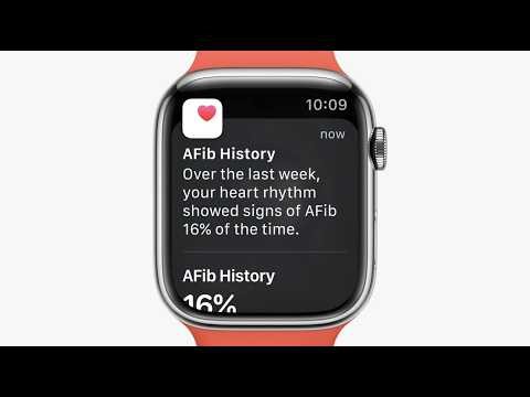 Apple Watch AFib History Arrives in Mainland China: What It Means for Users
