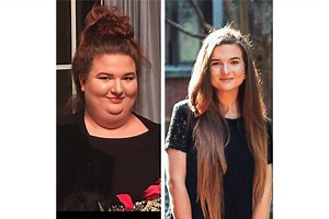 Unlock Dramatic Transformations with Weight Loss Surgery: The 10 Most Important Considerations