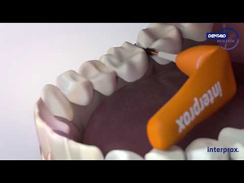 The interproximal cleaning revolution has arrived: New Interprox®