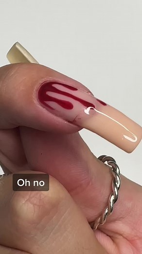 Nail art is kinda ironic now🥲 #brokennail #nails #nailrepair #nailsofinstagram #nailsoftheday #naturalnails #nailcare #nailcareroutine #nailcaretips #nailgrowth #nailgrowthjourney #longnails #longnaturalnails #nailinspo #fyp #foryoupage