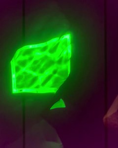 Mapping veins in the foot. This patient requested treatment and we mapped the veins using fluorescence technology. The Vein Treatment Center is the preeminent Vein Center in Buffalo Niagara. We have focused on Vein Only Care since 2005, way before others figured out that specialization is key to providing the best vein care to our patients. 99% of our patients come to our facility for management of venous disease: venous insufficiency, varicose veins, spider veins and other serious vein conditio