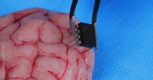 Close up of medical nurse or doctor hand in safety gloves installs a computer chip into the brain of a living being. Global Chipization. Human 2.0. Modern treatment of brain diseases.