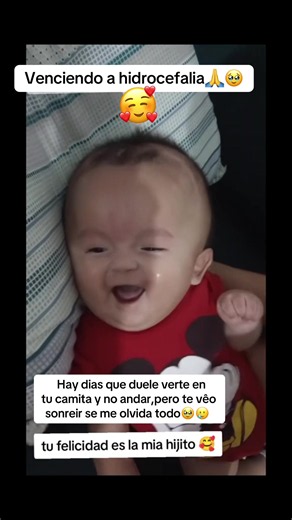 #hidrocefalia #usa #viralvideo #foryou #forgoupage | hydrocephalus puppy