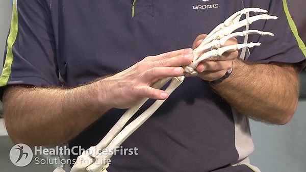 What is Carpal Tunnel Syndrome and how is it caused