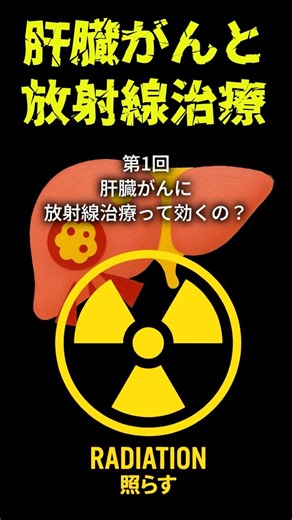 【肝臓がんと放射線治療①】「 肝臓がんに放射線治療って効くの？」#肝臓がん #肝細胞癌 #放射線治療 #定位放射線治療 #陽子線治療 #重粒子線治療 #健康情報 #shorts