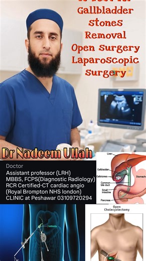 Dr Nadeem Ullah | ‎پتے کا آپریشن: (Laparoscopic) بہتر ہے یا اوپن سرجری؟ مکمل معلومات #laproscopicsurgery #opensurgery #gallbladder’s tones‎ | Instagram