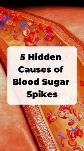5 Hidden Causes of Blood Sugar Spikes. #diabetic #diabetestipo2 #diabetestype2 #bloodsugar #health #diabetesfood #healthyfood #healthylifestyle | Diabetes control