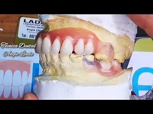 TCS PROTESIS FLEXIBLES