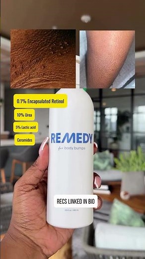 Acanthosis Nigricans and Ichthyosis Vulgaris treatment