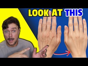 Skin Miracle Makes Your Hands Look Younger Fast