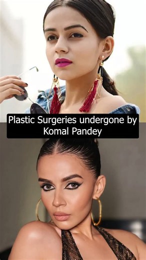 Dr Mithun Panchal on Instagram: "Komal Pandey’s Aesthetic Evolution: Analysis Komal Pandey is a true icon when it comes to fashion and bold aesthetics, and her facial features have subtly evolved over her career in the spotlight. We’re analyzing the changes that have refined her look: ~ Book your consultation with Dr. Mithun Panchal today at Essence Aesthetic Clinic ~ Call us on:+91-9016929201/ 9016925883 . DISCLAIMER :This video is intended for educational purposes only. It does not endorse, pr