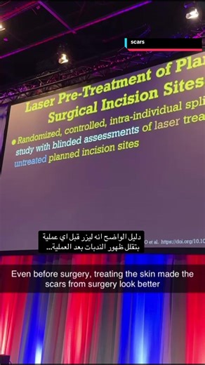 Laser Treatment for Reducing Surgical Scars