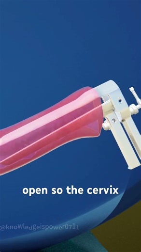 HPV Testing Explained (3D Animation) #HPVtesting #HPV #womenshealth #cervicalhealth #medical3d