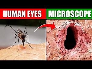 ऐसी चीजें जो आप केवल माइक्रोस्कोप से देख सकते हैं 10 Things You Can Only See Under Microscope