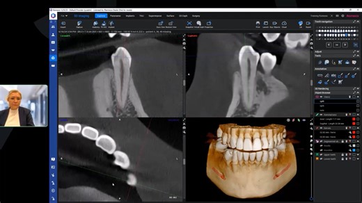 Romexis masterclass: Learn to use 3D imaging tools
