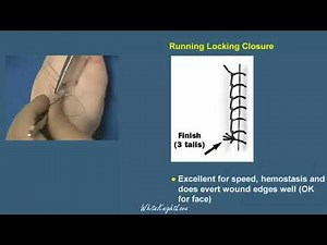 7 5 Running Lock Closure Suture Techniques Essential Surgical Skills WhiteKnightLove