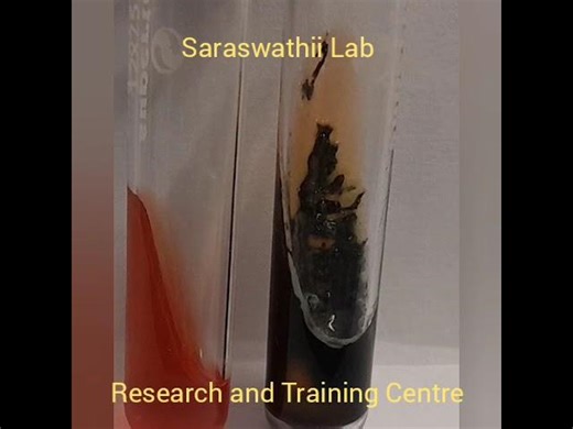 TSI Interpretation of results to differentiateSalmonella, E.coli and enterobacteriaceae | Dr. Kalidoss Rajendran