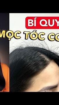 BÍ QUYẾT TÓC CON MỌC CỰC KỲ HIỆU QUẢ & BÌNH DÂN [Video có chứa Affiliate Marketing]