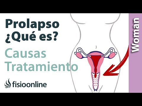🚺What is a PROLAPSE, CAUSES and TREATMENT🤔
