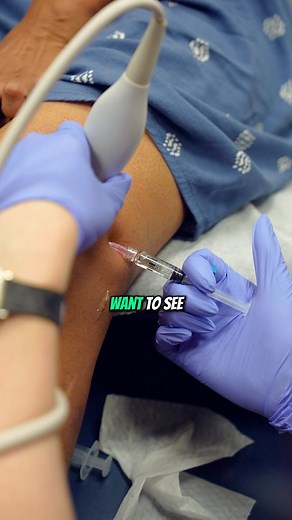 A knee gel injection, also known as viscosupplementation, involves injecting hyaluronic acid directly into the knee joint. This procedure aims to lubricate the joint, reduce pain, and improve mobility in individuals with osteoarthritis. Hyaluronic acid is a natural substance found in joint fluid that helps cushion and lubricate the joint. The injection can provide relief for several months and is typically considered when other treatments, like pain relievers or physical therapy, are not effecti